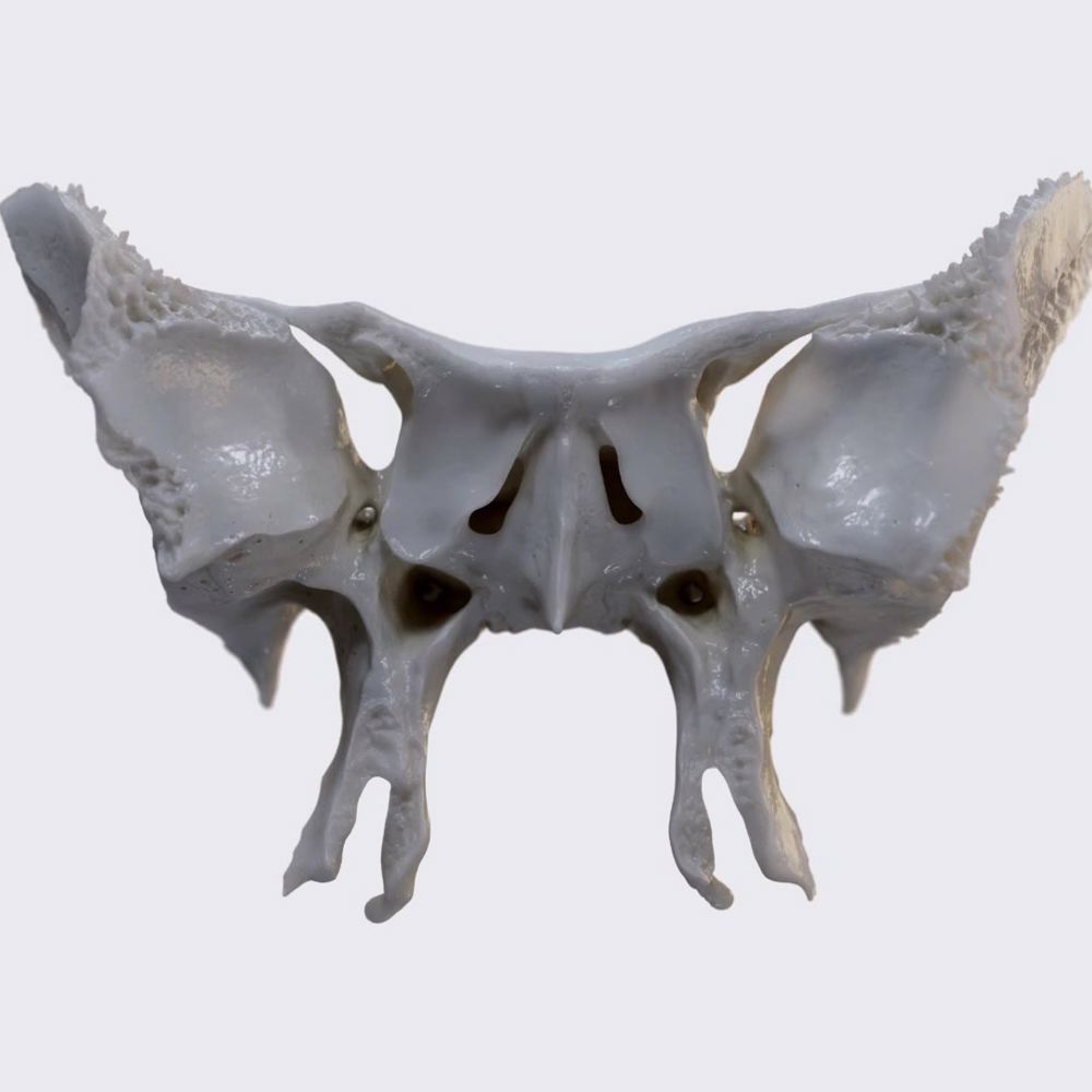 Sphenoid bone (landmarks)